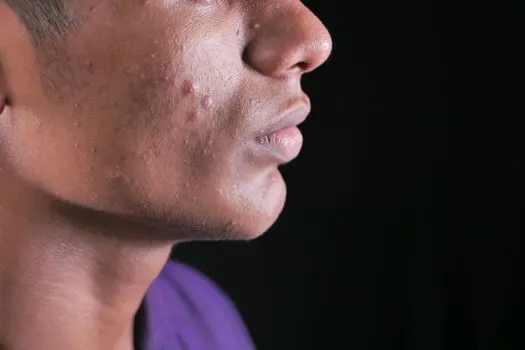 Thyroid — Щитовидная железа