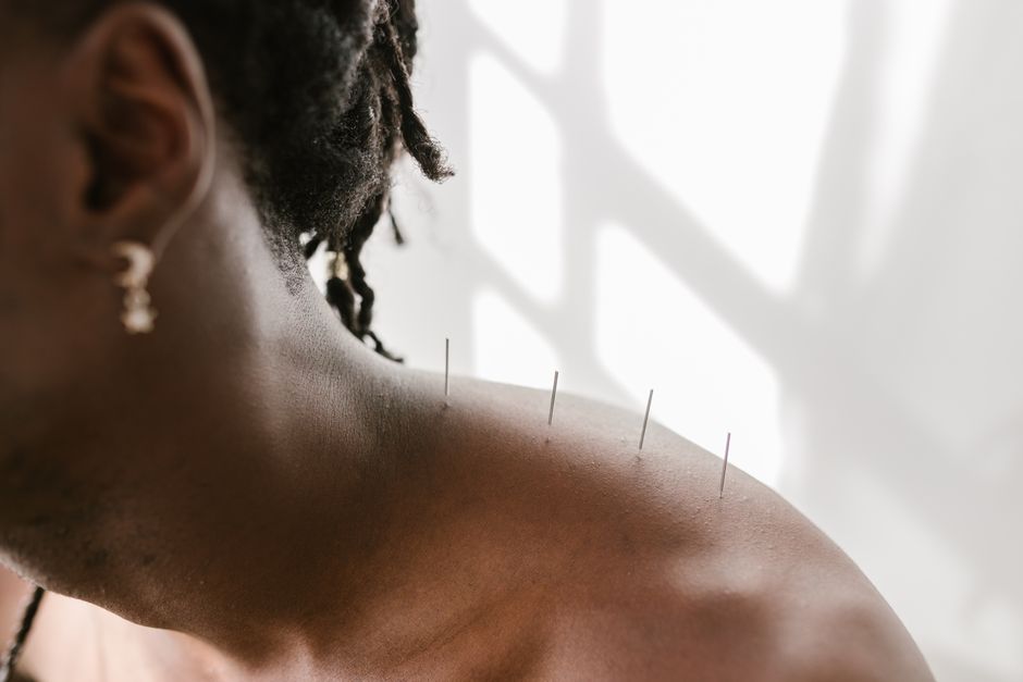 Acupuncture points — акупунктурные точки