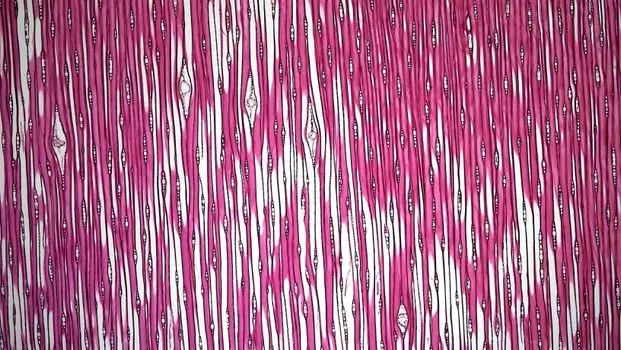 Fibrous membranes — Волокнистые мембраны