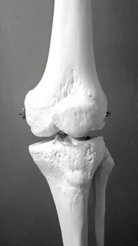 Ligament — Связка