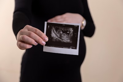 Fetus — плод