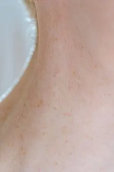 nape — шея