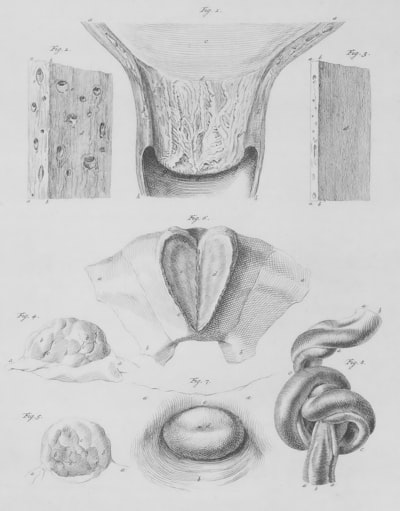 Morphology — морфология