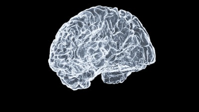 braincells — клетки мозга