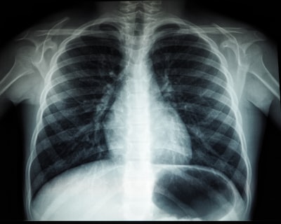 diagnosed — диагностировал