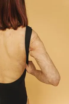 Tumor — Опухоль