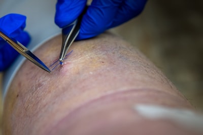 Suture — хирургический шов