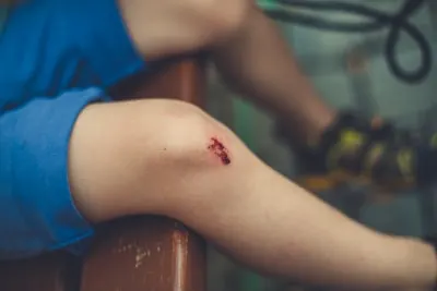 itch to the scratch — утолить зуд