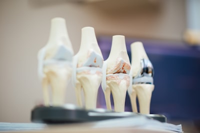 Joint hip replacement — эндопротезирование тазобедренного сустава