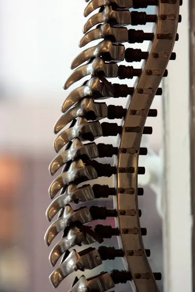 scoliosis — сколиоз