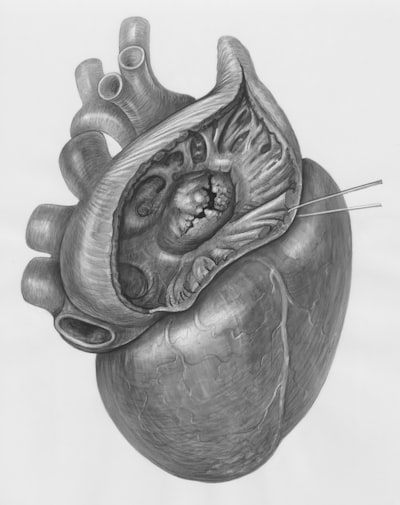 Pacemaker implantation — имплантация кардиостимулятора
