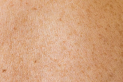 To get under my skin — выводить из себя