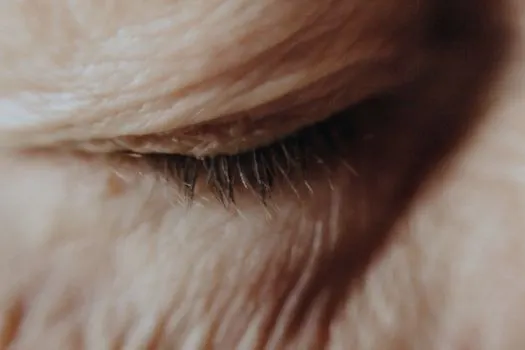 Eyelid — Веко
