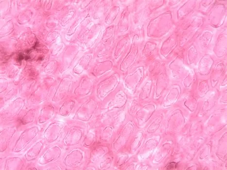 Body granulomas — Гранулемы тела