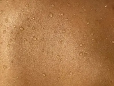 shed skin — сбрасывать кожу