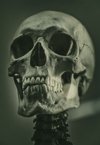 Skeletal — истощённый