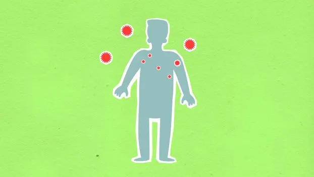 Measles — Корь